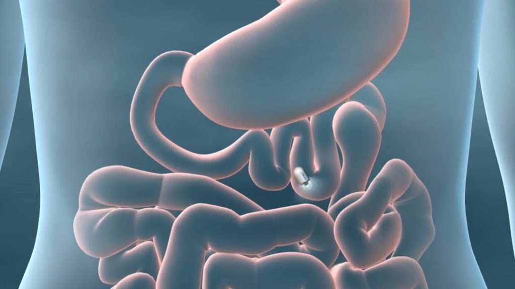 Una telecamera da inghiottire