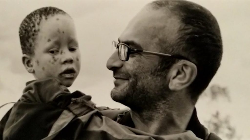 Albini africani, tragedia da raccontare