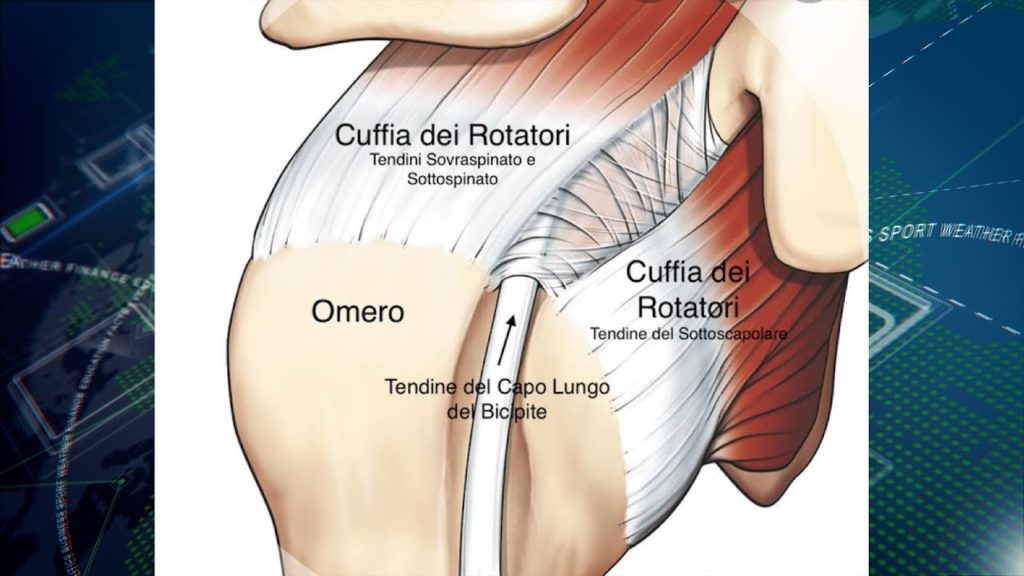Cuffie e lesioni, una spalla... su cui piangere