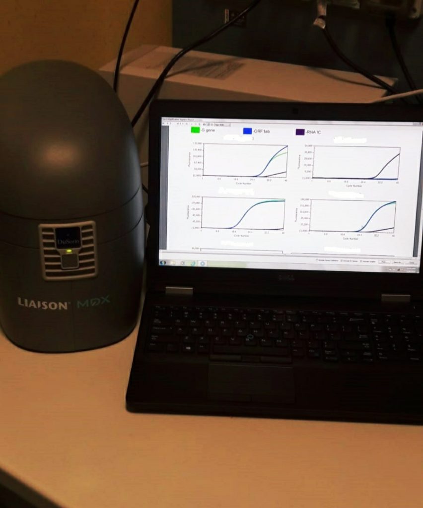 Circolo rapido, virus-test in 70 minuti