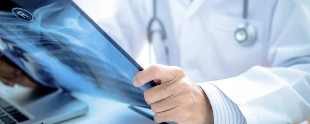 Prevenzione Covid, al via le radiografie nelle RSA