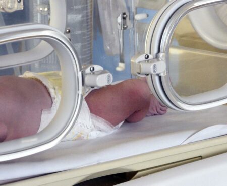 Varese: Ospedale Del Ponte e dei record, 18 nati in 24 ore