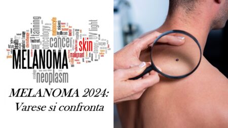 Varese: Contro il melanoma, confronto in ConfCommercio