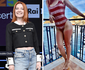 Dalla chioma alle gambe, Noemi ironizza sulla scottatura: "Mai senza crema"